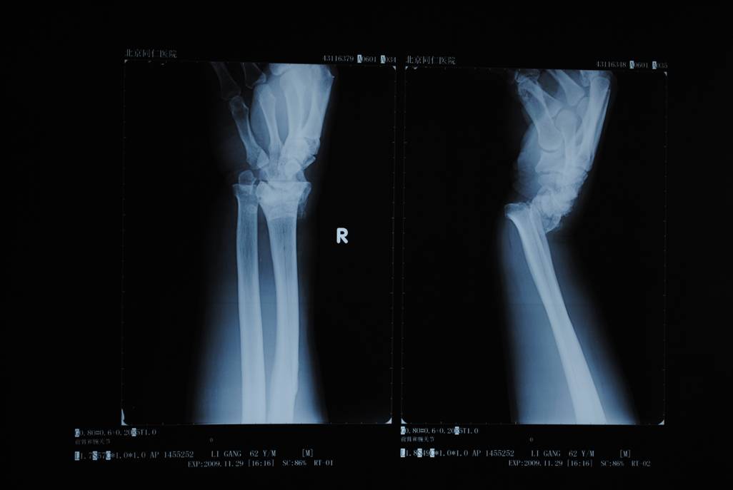 1649647358280546.jpg 201334192257331.jpg