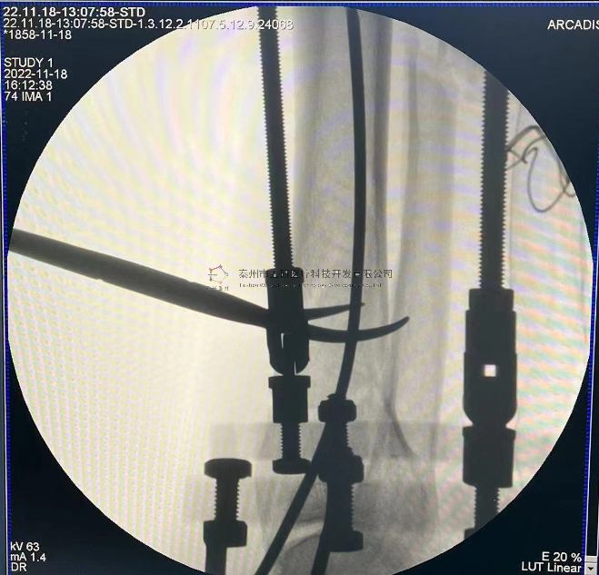 1676600873150413.png 11.png